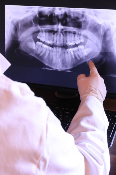 Best Chipped Tooth Repair Near Me  in Taylor, AZ